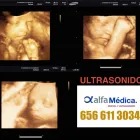 La imagen 1 de la Empresa ALFA MÉDICA ULTRASONIDO en Ciudad Juárez CHH
