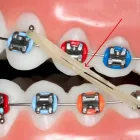La imagen 2 de la Empresa BRACKETS CON ESTILO GUADALAJARA Salud y Medicina en Guadalajara JAL