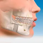 La imagen 2 de la Empresa CENT DE ORTOPEDIA MAXILAR Y CIRUGÍA MAXI Salud y Medicina en La Piedad MIC