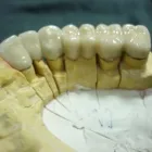 La imagen 3 de la Empresa CENTRO DE ENSEÑANZA Y ESPECIALIZACION DE MECANICA DENTAL en Ciudad De México CMX