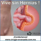 La imagen 5 de la Empresa CIRUGIA AVANZADA CDMX Salud y Medicina en Ciudad De México CMX
