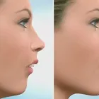 La imagen 1 de la Empresa CIRUGIA ESTETICA Y FUNCIONAL MAXILOFACIAL S C en Guadalajara JAL