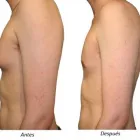 La imagen 3 de la Empresa CIRUGÍA PLÁSTICA COLIMA DR. EDGAR CÁRDENAS C. Salud y Medicina en Cuauhtemoc CHH