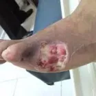 La imagen 1 de la Empresa CLINICA DE OZONOTERAPIA Salud y Medicina en Villahermosa TAB