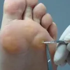La imagen 2 de la Empresa CLINICA DE OZONOTERAPIA Salud y Medicina en Villahermosa TAB