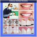 La imagen 2 de la Empresa CLÍNICA DENTAL MODELO Salud y Medicina en Hermosillo SON