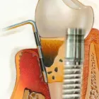 La imagen 3 de la Empresa CLÍNICA ODONTOLÓGICA ESPECIALIZADA MILENIO Salud y Medicina en Querétaro QUE