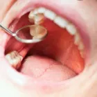 La imagen 2 de la Empresa CONSULTORIO DENTAL GALVÁN Salud y Medicina en Mexicali BCN