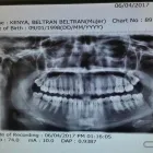 La imagen 1 de la Empresa DR. ABEL F. MILLAN CIRUJANO MAXILOFACIAL Salud y Medicina en Culiacán SIN