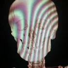 La imagen 2 de la Empresa DR. ABEL F. MILLAN CIRUJANO MAXILOFACIAL Salud y Medicina en Culiacán SIN