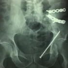 La imagen 1 de la Empresa DR. ALBERTO MUÑOZ MACIAS en Querétaro QUE