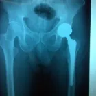 La imagen 2 de la Empresa DR. ALBERTO MUÑOZ MACIAS en Querétaro QUE