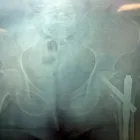 La imagen 3 de la Empresa DR. ALBERTO MUÑOZ MACIAS en Querétaro QUE