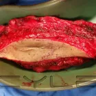 La imagen 1 de la Empresa DR.ARMANDO BASILIO ROQUE CIRUJANO ONCOLOGO Salud y Medicina en Puebla MEX