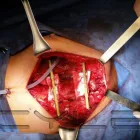 La imagen 3 de la Empresa DR.ARMANDO BASILIO ROQUE CIRUJANO ONCOLOGO Salud y Medicina en Puebla MEX