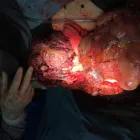 La imagen 4 de la Empresa DR.ARMANDO BASILIO ROQUE CIRUJANO ONCOLOGO Salud y Medicina en Puebla MEX