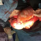 La imagen 6 de la Empresa DR.ARMANDO BASILIO ROQUE CIRUJANO ONCOLOGO Salud y Medicina en Puebla MEX