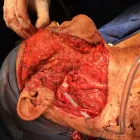 La imagen 7 de la Empresa DR.ARMANDO BASILIO ROQUE CIRUJANO ONCOLOGO Salud y Medicina en Puebla MEX