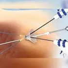 La imagen 3 de la Empresa DR. DAMIAN VARELA Salud y Medicina en Tijuana BCN