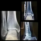 La imagen 1 de la Empresa DR. ESTEBAN CASTRO CONTRERAS TRAUMATÓLOGO Y ORTOPEDISTA Salud y Medicina en Guadalajara JAL