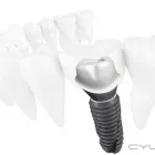 La imagen 6 de la Empresa DR FERNANDO GALLO ORTEGA Salud y Medicina en Guadalajara JAL