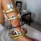 La imagen 2 de la Empresa DR. J. LEOPOLDO URQUIZA BELTRAN Salud y Medicina en Mexicali BCN