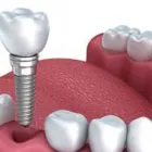 La imagen 2 de la Empresa DR. JORGE MARTINEZ V. Salud y Medicina en Mexicali BCN