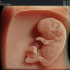 La imagen 3 de la Empresa DR. JOSE ANTONIO MÉNDEZ GONZÁLEZ Salud y Medicina en Querétaro QUE