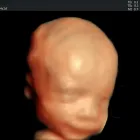 La imagen 5 de la Empresa DR. JOSE ANTONIO MÉNDEZ GONZÁLEZ Salud y Medicina en Querétaro QUE