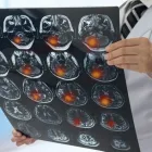 La imagen 2 de la Empresa DR. RAÚL HERNÁNDEZ PAGAZA Salud y Medicina en Toluca CMX