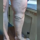 La imagen 2 de la Empresa DR RUBEN MONTOYA VELAZQUEZ Salud y Medicina en Celaya GUA