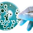 La imagen 3 de la Empresa DR. SAMUEL NAVARRO ÁLVAREZ Salud y Medicina en Tijuana BCN