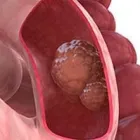 La imagen 2 de la Empresa DR WILFRIDO ZAZUETA GÓMEZ Salud y Medicina en Culiacán SIN