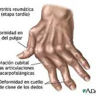 La imagen 3 de la Empresa DRA. DESIRÉE SEPÚLVEDA ALDANA Salud y Medicina en Mexicali BCN