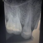 La imagen 5 de la Empresa DRA. ELISA NELLY DE LA GARZA S. CE-DENTAL Salud y Medicina en San Pedro Garza García NLE