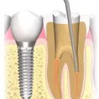La imagen 6 de la Empresa DRA. ELISA NELLY DE LA GARZA S. CE-DENTAL Salud y Medicina en San Pedro Garza García NLE