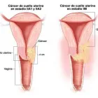 La imagen 1 de la Empresa DRA MARIA DE LOS ANGELES CROSTHWAITE Salud y Medicina en Tijuana BCN