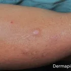 La imagen 1 de la Empresa DRA. MARY ANN WEAVER VELASCO Salud y Medicina en Queretaro QUE