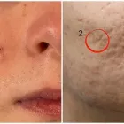 La imagen 2 de la Empresa DRA. MARY ANN WEAVER VELASCO Salud y Medicina en Queretaro QUE