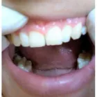 La imagen 1 de la Empresa ESPECIALIDAD DENTAL BIOLASER DRA ELOYNA Salud y Medicina en Ciudad Valles SLP