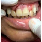 La imagen 2 de la Empresa ESPECIALIDAD DENTAL BIOLASER DRA ELOYNA Salud y Medicina en Ciudad Valles SLP