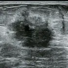 La imagen 14 de la Empresa GABINETE DE RADIOLOGIA Y ULTRASONIDO SAN CRISTOBAL Salud y Medicina en Mérida YUC