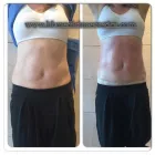 La imagen 2 de la Empresa HEALTH AND BEAUTY FOR YOU Salud y Medicina en Ciudad De México CMX