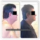 La imagen 3 de la Empresa HEALTH AND BEAUTY FOR YOU Salud y Medicina en Ciudad De México CMX