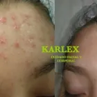 La imagen 1 de la Empresa KARLEX CUIDADO FACIAL Y CORPORAL Salud y Medicina en Mexicali BCN
