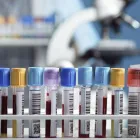 La imagen 2 de la Empresa LABORATORIOS DE ANÁLISIS CLÍNICOS ICER Salud y Medicina en Saltillo COA