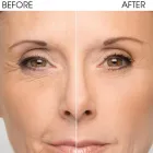 La imagen 1 de la Empresa MASAJES PROFES Y TRATAM FACIALES Salud y Medicina en Heroica Puebla De Zaragoza PUE