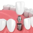 La imagen 2 de la Empresa MAXILODENTAL Salud y Medicina en Monterrey NLE
