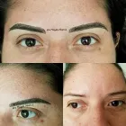 La imagen 3 de la Empresa MEDIESTÉTICA ACAPULCO Salud y Medicina en Acapulco GRO