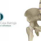 La imagen 3 de la Empresa PRÓTESIS DE CADERA Y CIRUGÍA DE RODILLA EN GUADALAJARA Salud y Medicina en Guadalajara JAL